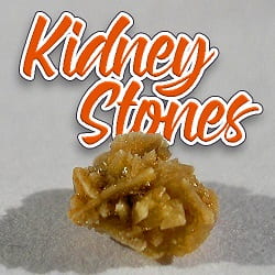 Kidney Stone Integrative Medicine Approach