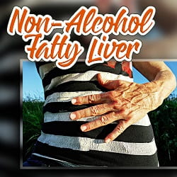 Non-Alcoholic Fatty Liver - Functional Medicine