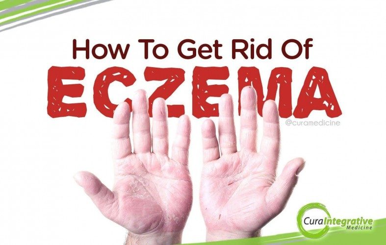How To Get Rid Of Eczema