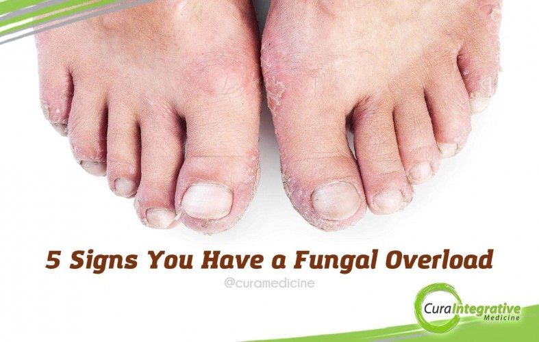 5 Signs You Have a Fungal Overload